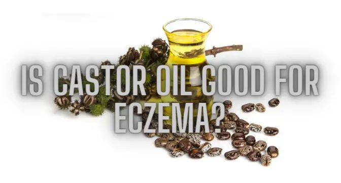 Is Castor Oil Good For Eczema? – EczemaFeed